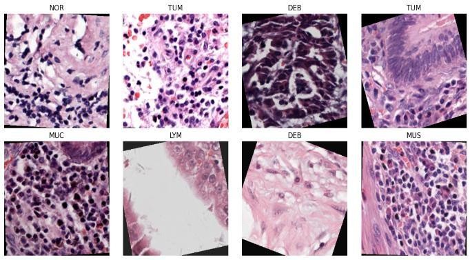 Final output: sample tissue patches with predicted classes.