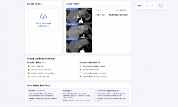 Liver Tumor Detection Results and Analysis Report.
