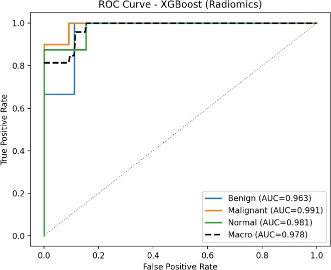 One-vs-rest ROC curves with per-class and macro-averaged AUC for the four evaluated models: (a) XGBoost (Radiomics), (b) Random Forest (Radiomics), (c) Deep Fusion, and (d) Ensemble.