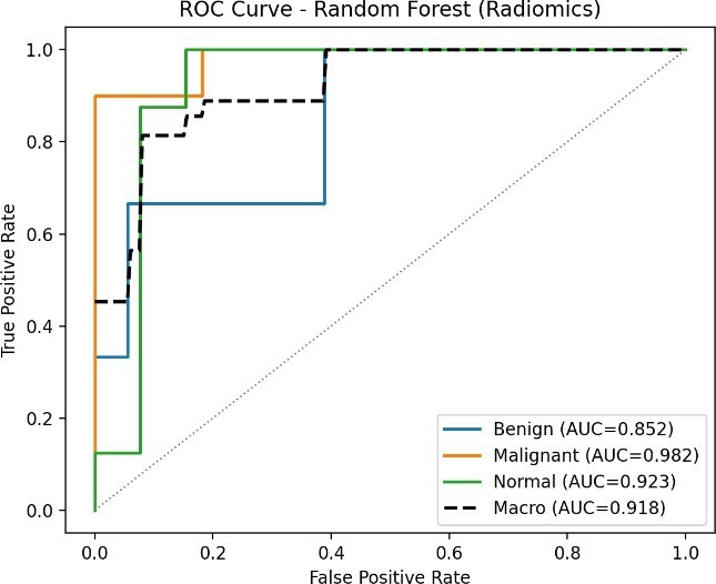 One-vs-rest ROC curves with per-class and macro-averaged AUC for the four evaluated models: (a) XGBoost (Radiomics), (b) Random Forest (Radiomics), (c) Deep Fusion, and (d) Ensemble.