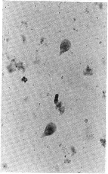 Giardia intestinalis trophozoites in a stool wet mount.
