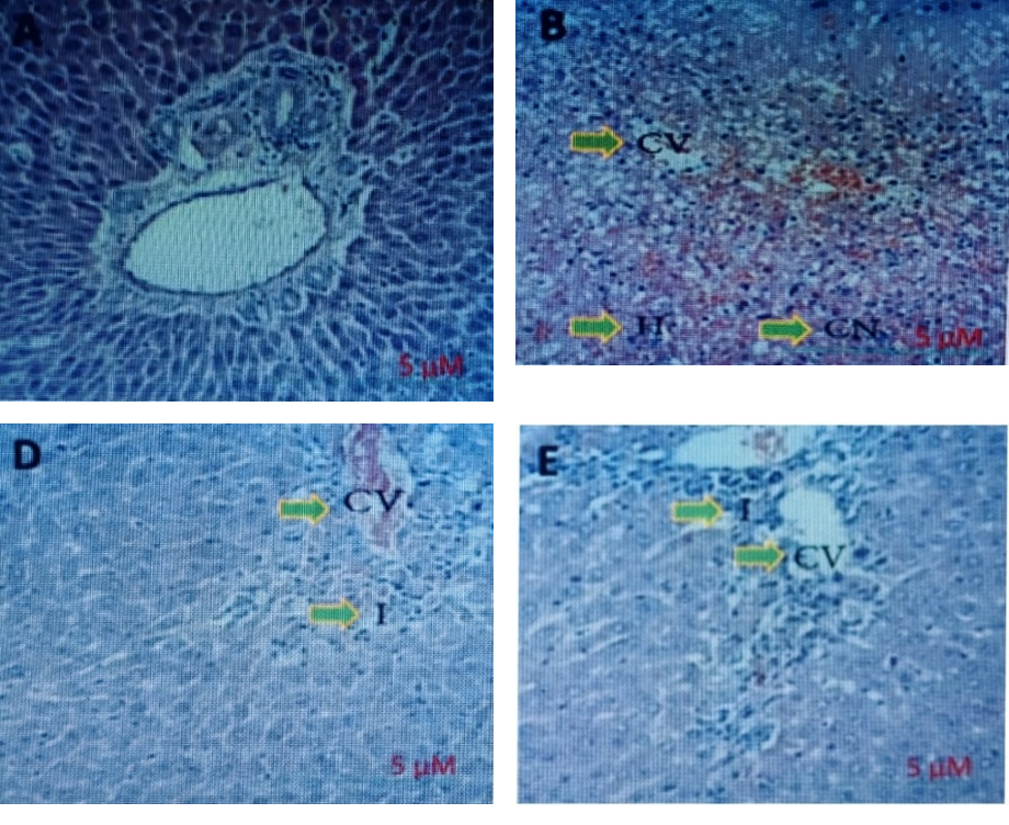 Histopathology of liver tissue (H&E); panels as labelled by the author: A, B, D and E.